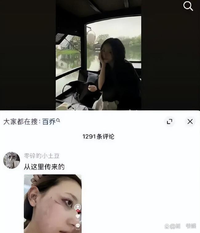 千万网红张百乔再传婚变 急售别墅